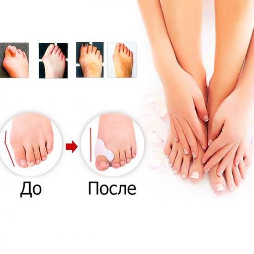 Фиксатор большого пальца Valgus Pro (2 шт.)